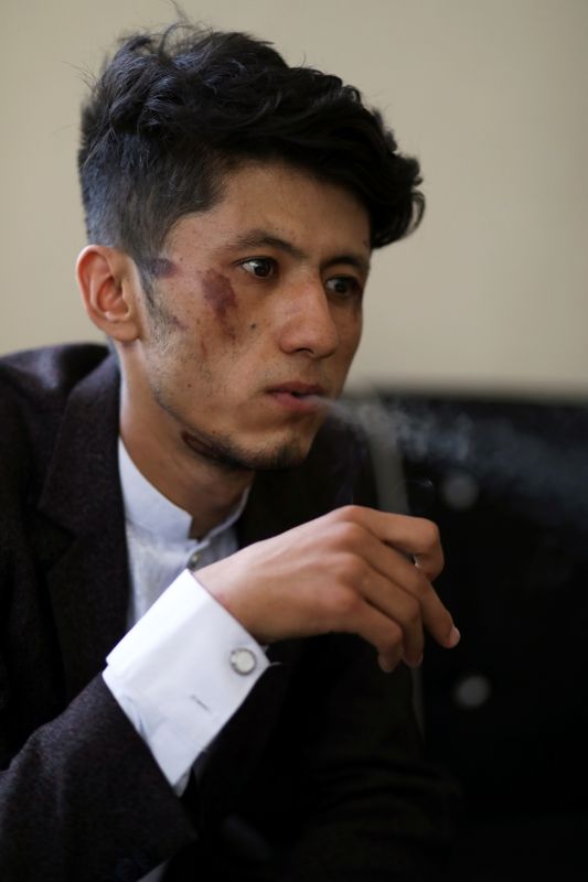 &copy; Reuters. صحفي يعمل لحساب صحيفة اطلاعات نيوز الأفغانية بعد تعرضه للضرب أثناء احتجازه لدى حركة طالبان في صورة التقطت بمقر الصحيفة بكابول يوم الخميس. ص