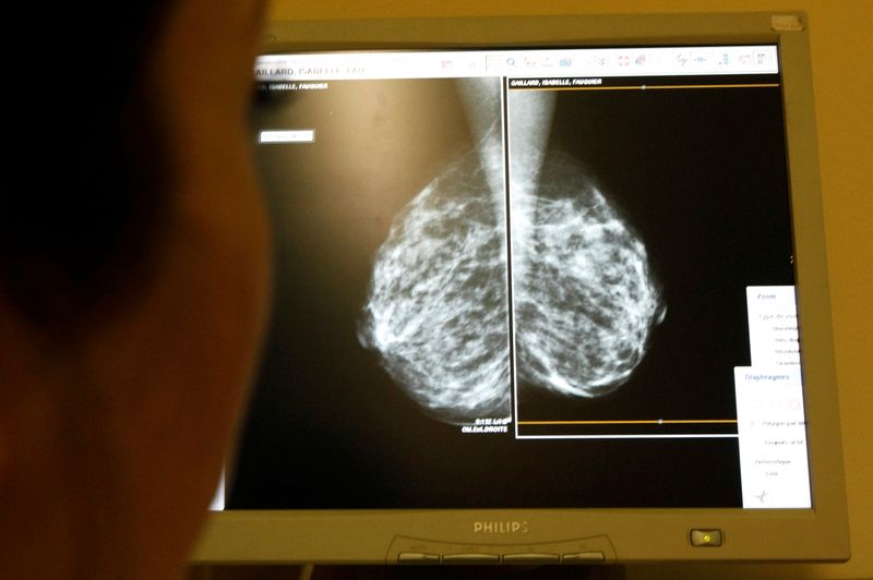 &copy; Reuters. FILE PHOTO: A doctor exams mammograms, a special type of X-ray of the breasts, which is used to detect tumors as part of a regular cancer prevention medical check-up at a clinic in Nice, south eastern France January 4, 2008.       REUTERS/Eric Gaillard/Fi