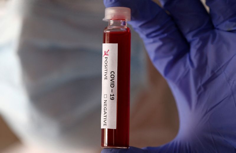 © Reuters. FILE PHOTO: Fake blood is seen in test tubes labelled with the coronavirus (COVID-19) in this illustration taken March 17, 2020. REUTERS/Dado Ruvic/Illustration/File Photo