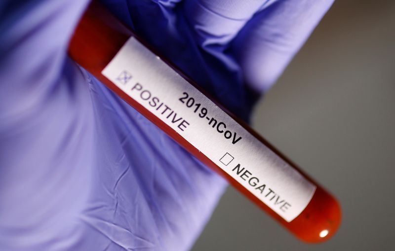 &copy; Reuters. FOTO DE ARCHIVO: Tubo de ensayo con la etiqueta del coronavirus en esta ilustración tomada el 29 de enero de 2020. REUTERS/Dado Ruvic