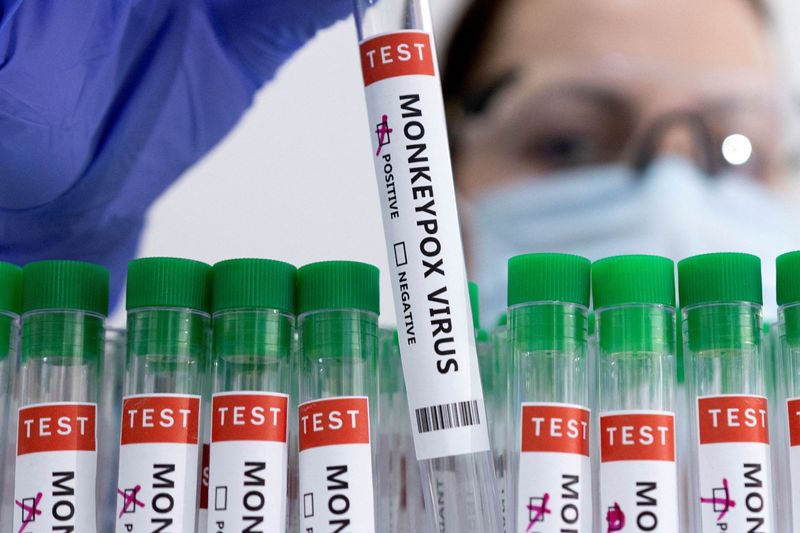 &copy; Reuters. FOTO DE ARCHIVO. Imagen de ilustración de tubos de ensayo con la etiqueta "Virus de la viruela del mono positivo". 23 de mayo de 2022. REUTERS/Dado Ruvic