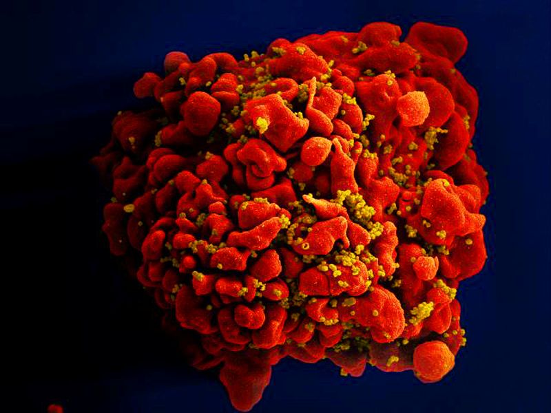 &copy; Reuters. FILE PHOTO - A digitally colorized scanning electron microscopic image depicts a single, red colored H9-T cell that had been infected by numerous, spheroid shaped, mustard colored human immunodeficiency virus (HIV) particles attached to the cell's surface