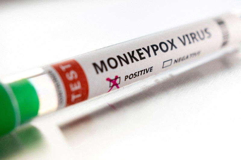 &copy; Reuters. FOTO DE ARCHIVO: Un tubo de ensayo etiquetado como "virus de la viruela del mono positivo" se ve en esta ilustración tomada el 22 de mayo de 2022. REUTERS/Dado Ruvic