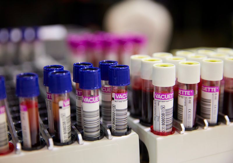 &copy; Reuters. عينات من الدم التقطت في حدث للتبرع بالدم في سويسرا بصورة من أرشيف رويترز.