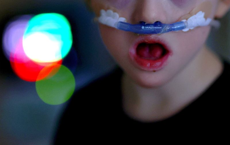 &copy; Reuters. Un niño con una infección pulmonar recibe ventilación asistida en la unidad de cuidados intensivos pediátricos del Hospital St. Joseph Tempelhof de Berlín, Alemania. 5 de diciembre de 2022. REUTERS/Lisi Niesner