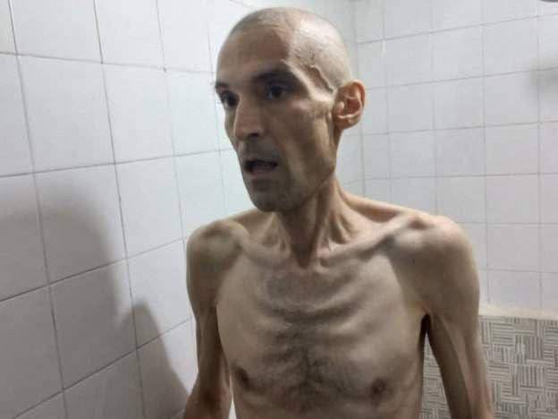 Images of emaciated Iranian prisoner on hunger strike prompt outrage