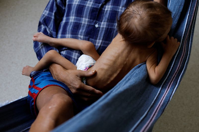 &copy; Reuters. Criança yanomami de 4 anos internada em hospital de Boa Vista para tratar desnutrição
27/01/2023
REUTERS/Amanda Perobelli