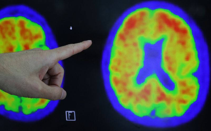 Exclusive-US to build $300 million database to fuel Alzheimer's research