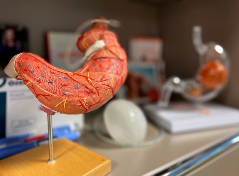 &copy; Reuters. FILE PHOTO: A view of a plastic model of a stomach during an interview with Doctor Thomas Horbach, specialist in surgery, visceral surgery and nutritional medicine on Novo Nordisk, which will start selling its hugely popular obesity drug Wegovy in Germany