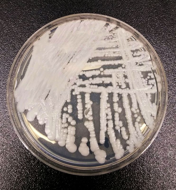 © Reuters. A strain of Candida auris cultured in a petri dish at the Centers for Disease Control and Prevention is pictured in this undated handout photo. CDC/Handout via REUTERS