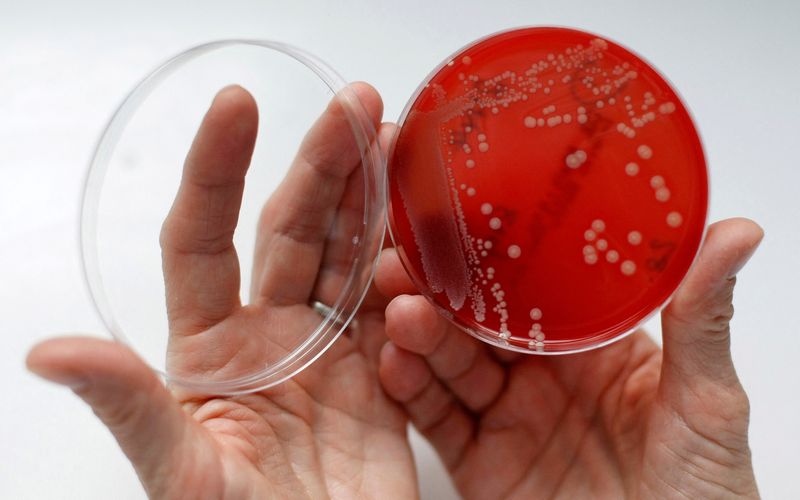 &copy; Reuters. FILE PHOTO: An employee displays MRSA (Methicillin-resistant Staphylococcus aureus) bacteria strain inside a petri dish containing agar jelly for bacterial culture in a microbiological laboratory in Berlin March 1, 2008. REUTERS/Fabrizio Bensch (GERMANY)/