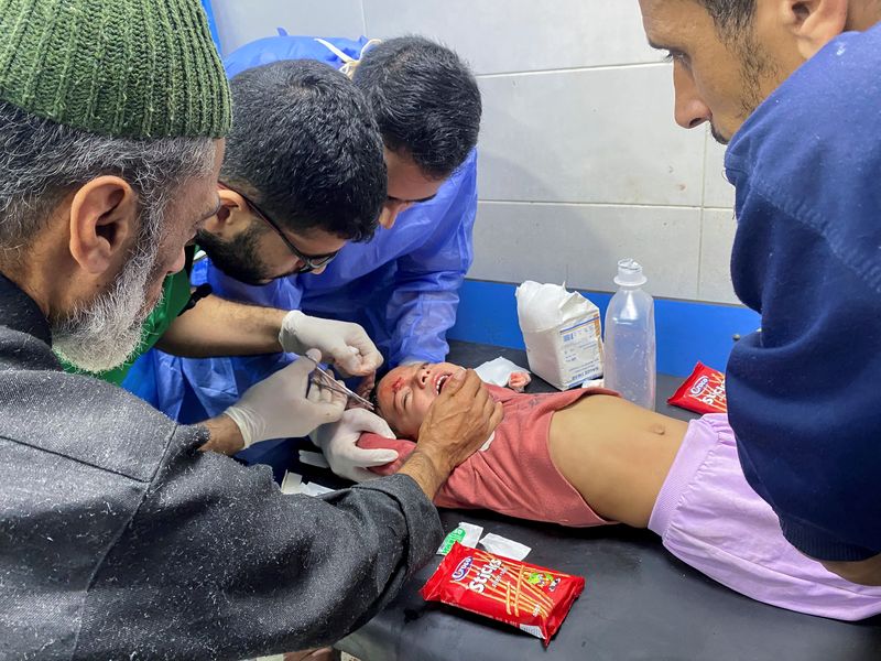 &copy; Reuters. Una niña palestina, Orheen Al-Dayah, herida como consecuencia de un ataque israelí en la frente en el marco del actual conflicto entre Hamás e Israel, recibe puntos de sutura sin anestesia en el hospital Al Shifa de la ciudad de Gaza, 8 de noviembre de