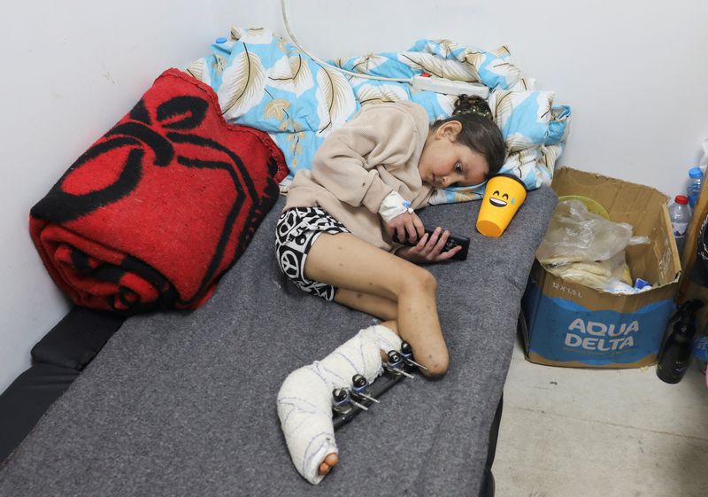 &copy; Reuters. الطفلة الفلسطينية إيمان الخولي التي بترت قدمها بعد إصابتها جراء أحدى الغارات الإسرائيلية التي قتلت والديها أيضا تتلقي العلاج بالمستشفى ال