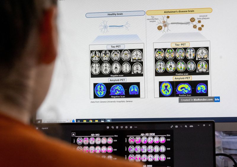 &copy; Reuters. FILE PHOTO: A scientist looks at scans of brains at the Memory Centre at the Department of Readaptation and Geriatrics of the University Hospital (HUG) in Geneva, Switzerland, June 6, 2023.  REUTERS/Denis Balibouse/File Photo