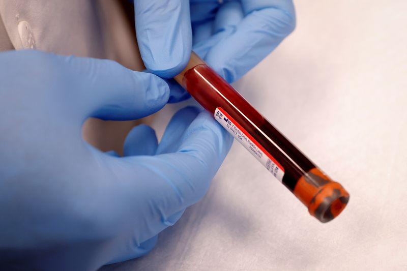 © Reuters. FILE PHOTO: A vial of blood is seen in a file photo. REUTERS/Mike Segar