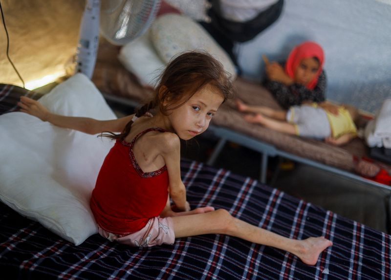 &copy; Reuters. Jana Ayad, a malnourished Palestinian girl, looks on as she receives treatment at the International Medical Corps field hospital, amid the Israel-Hamas conflict, in Deir Al-Balah in the southern Gaza Strip, June 22, 2024. REUTERS/Mohammed Salem