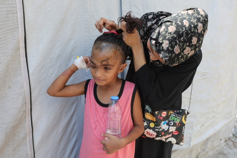 &copy; Reuters. Palestinian girl Sila Houso, who was injured in her head in an Israeli strike, has her hair styled by her mother, amid the Israel-Hamas conflict, at Al-Aqsa Martyrs Hospital in Deir Al-Balah in the central Gaza Strip, August 14, 2024. REUTERS/Ramadan Abed