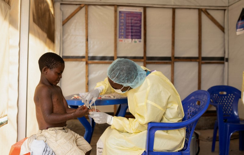 © Reuters. FILE PHOTO: Christian Musema, a laboratory nurse, takes a sample from a child with a suspected case of mpox, at a treatment centre in Munigi, near Goma, North Kivu province, Democratic Republic of the Congo July 19, 2024. REUTERS/Arlette Bashizi/File Photo