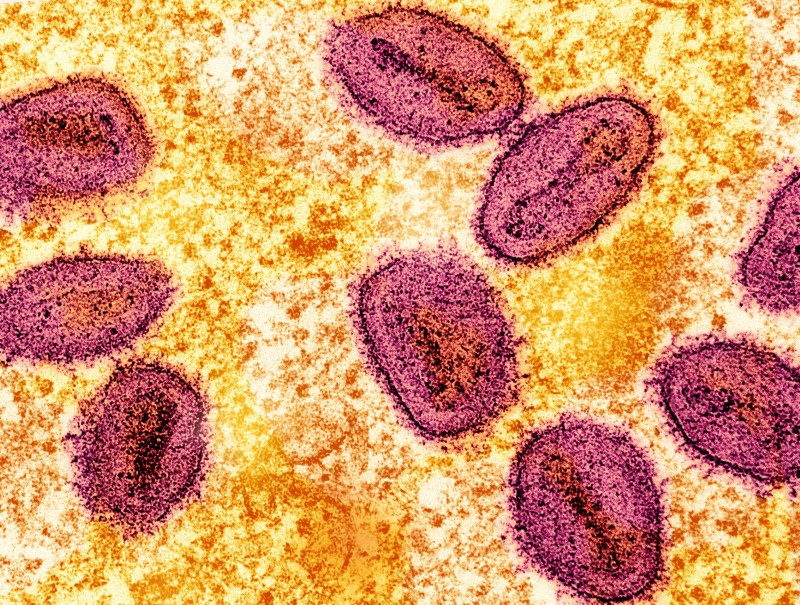 © Reuters. An undated colorized transmission electron micrograph of mpox virus particles (pink) found within an infected cell (yellow), cultured in the laboratory, captured at the National Institute of Allergy and Infectious Diseases (NIAID) Integrated Research Facility (IRF) in Fort Detrick, Maryland.  NIAID/Handout via REUTERS