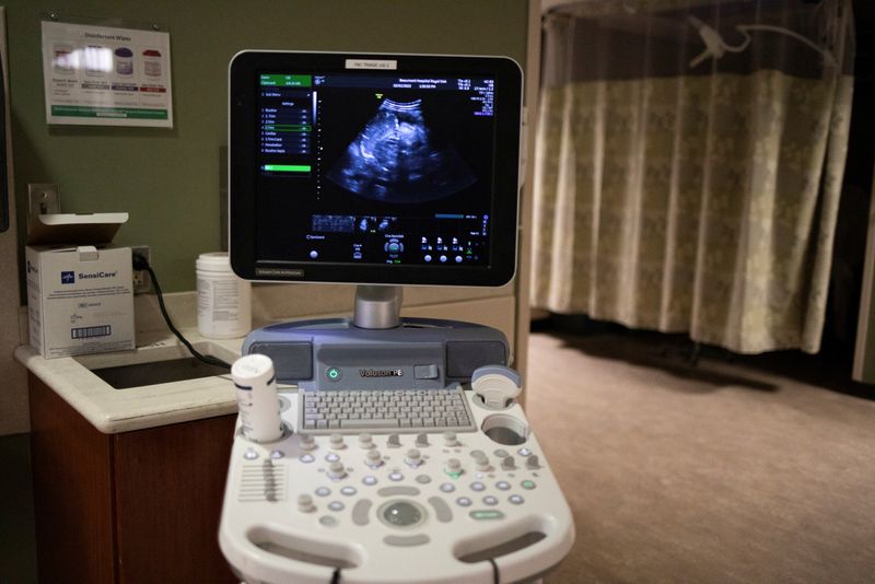 &copy; Reuters. FILE PHOTO: A recently scanned monitor showing a patients ultrasound in Michigan, U.S., February 1, 2022.  REUTERS/Emily Elconin