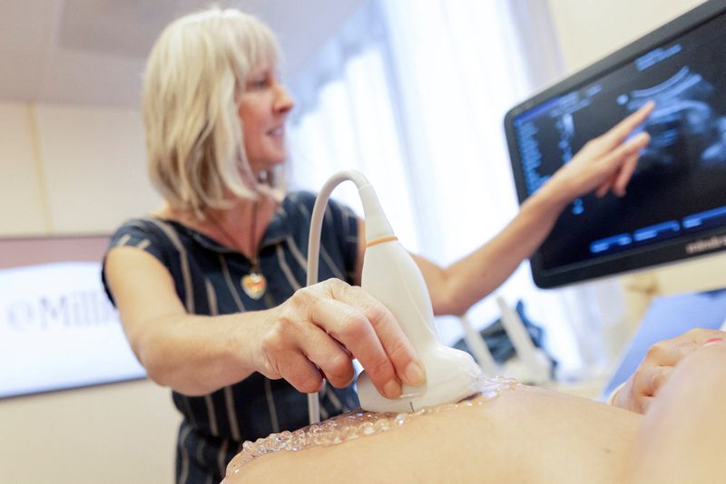 © Reuters. Cynthia Banks, a certified nurse midwife, points out different aspects of the baby as she performs an ultrasound on Alanna Evans during her 36-week checkup at the birthing centre run by Millie in Berkeley, California, U.S., August 1, 2024. REUTERS/Brittany Hosea-Small