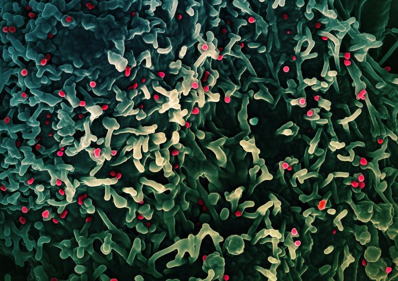 © Reuters. FILE PHOTO: An undated colorized scanning electron micrograph of mpox virus (red) on the surface of infected VERO E6 cells (green), captured at the National Institute of Allergy and Infectious Diseases (NIAID) Integrated Research Facility (IRF) in Fort Detrick, Maryland.  NIAID/Handout via REUTERS/File Photo