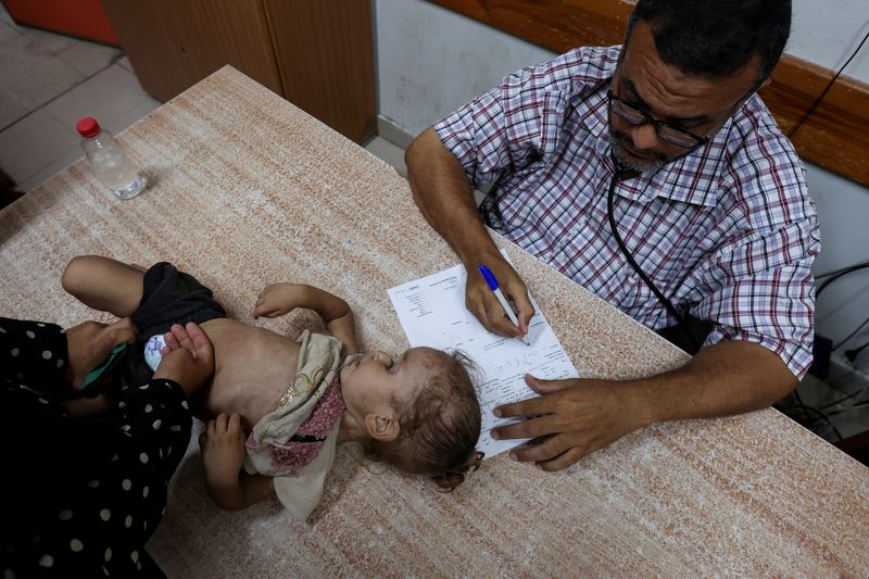 © Reuters. FILE PHOTO: A Palestinian girl is examined by a doctor amid fears over the spread of polio after the first case was reported by the Ministry of Health, as the conflict between Israel and Hamas continues, at Al-Aqsa Martyrs Hospital, in Deir Al-Balah in the central Gaza Strip, August 18, 2024. REUTERS/Ramadan Abed/File Photo