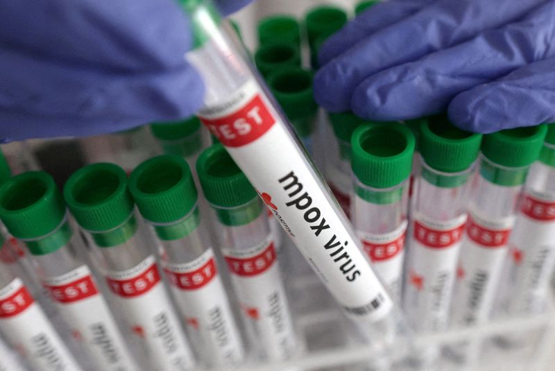 © Reuters. A labeled test tube 