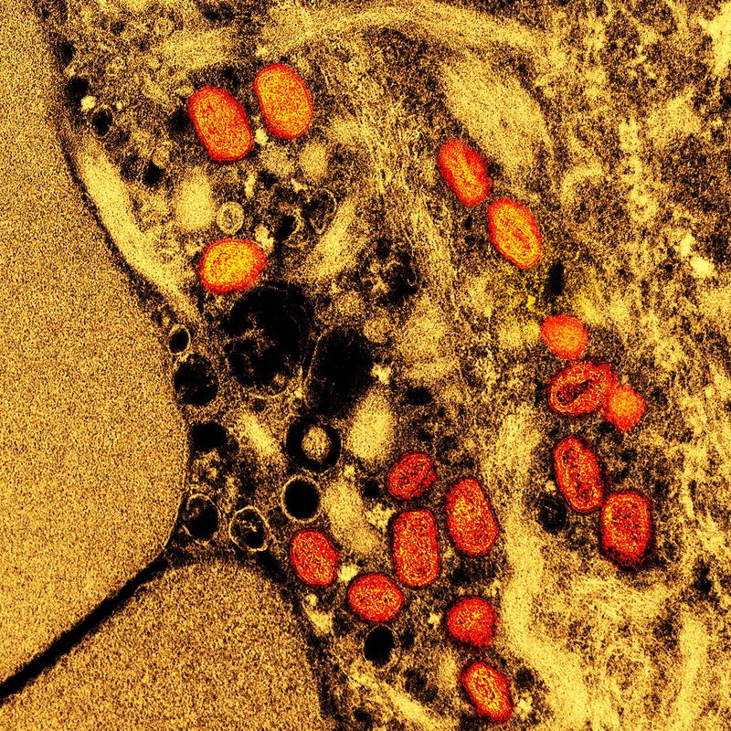 &copy; Reuters. Micrografia eletrônica de transmissão colorida de partículas do vírus mpox capturadas no NIAID Integrated Research Facility em Fort Detrickn  NIAID/Divulgação via REUTERS