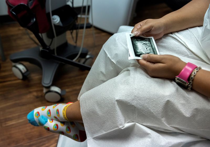 © Reuters. FILE PHOTO: A woman looks at a picture of her ultrasound at a clinic in Houston, Texas, U.S., October 1, 2021. REUTERS/Evelyn Hockstein/File Photo