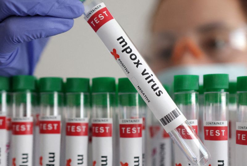 &copy; Reuters. FILE PHOTO: A test tube labelled "Mpox virus positive" is held in this illustration taken August 20, 2024. REUTERS/Dado Ruvic/Illustration/File Photo