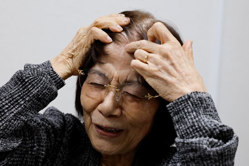 © Reuters. Teruko Yahata, who survived the 1945 atomic bombing of Hiroshima, shows a scar, as she speaks at an interview with Reuters on the following day of The Japan Confederation of A- and H-Bomb Sufferers Organizations (Nihon Hidankyo) winning the 2024 Nobel Peace Prize, in Hiroshima, Japan, October 12, 2024.  REUTERS/Kim Kyung-Hoon