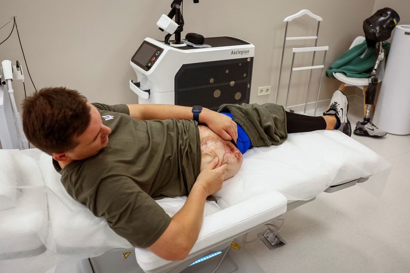 © Reuters. Oleksandr Chaika, 35-years-old, a former Ukrainian serviceman, who was wounded at a front line, attends a medical procedure in a clinic, which treats scars, amid Russia's attack on Ukraine, in Kyiv, Ukraine, October 11, 2024. REUTERS/Alina Smutko