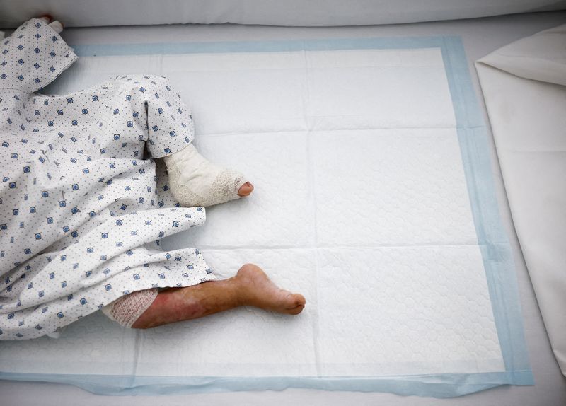 &copy; Reuters. Two-year-old Ivana Skayki, who suffered third-degree burns over nearly half of her body from an Israeli strike in southern Lebanon, lies in bed at Geitaoui Hospital in Beirut, Lebanon October 30, 2024. REUTERS/Yara Nardi   