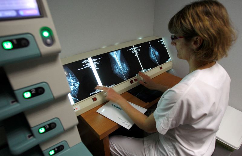 &copy; Reuters. FILE PHOTO: A radiologist examines breast X-rays after a cancer prevention medical check-up at the Ambroise Pare hospital in Marseille, southern France, on April 3, 2008.     REUTERS/Jean-Paul Pelissier/File Photo