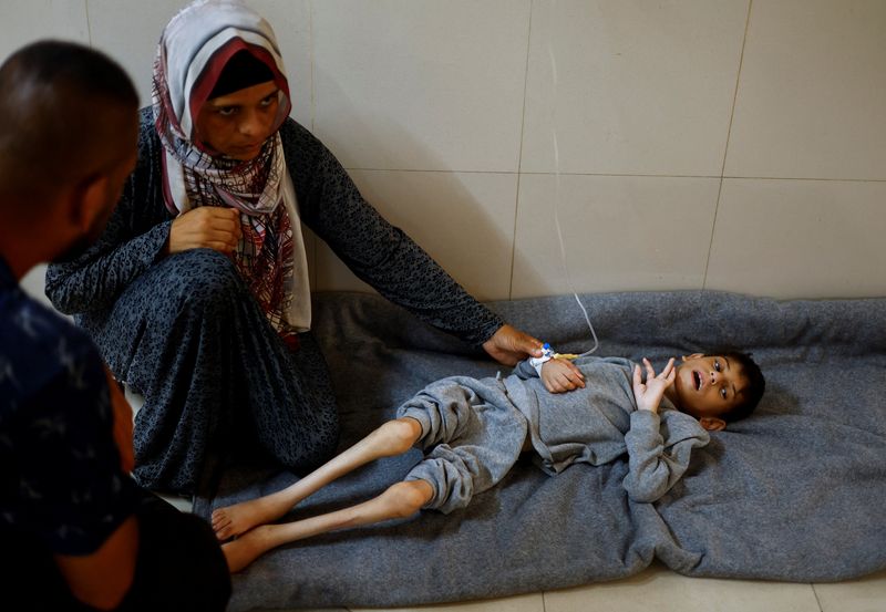 &copy; Reuters. Younis Joma, uma criança palestina com desnutrição, ao lado da mãe,  Ghaneyma Joma, no hospital Nasser, em Khan Younis, norte da Faixa de Gazan08/07/2024 REUTERS/Mohammed Salem/File Photo