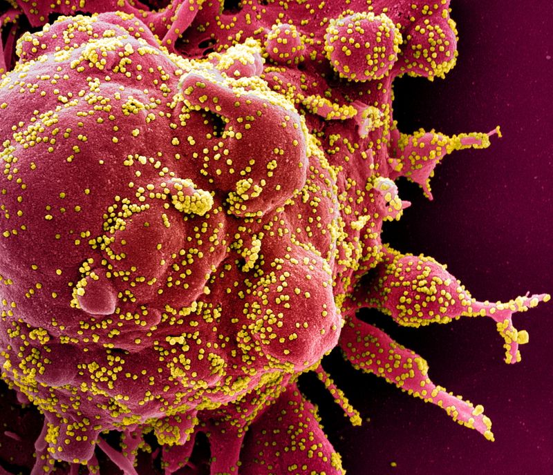 &copy; Reuters. FILE PHOTO: Colorized scanning electron micrograph of an apoptotic cell (red) infected with SARS-COV-2 virus particles (yellow), also known as novel coronavirus, isolated from a patient sample. Image captured at the NIAID Integrated Research Facility (IRF