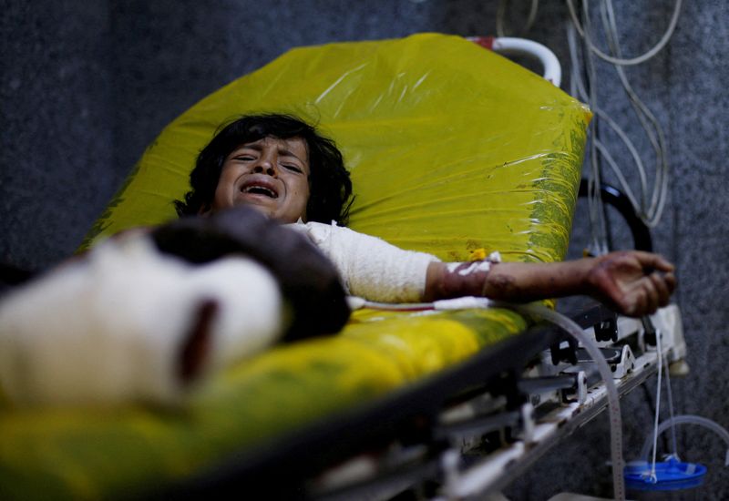 &copy; Reuters. FOTO DE ARCHIVO: Un niño de 12 años llora mientras yace en la camilla de un hospital de Saná tras ser herido en un ataque aéreo en la región de al-Jawf, Yemen, el 15 de julio de 2022. REUTERS/Khaled Abdullah