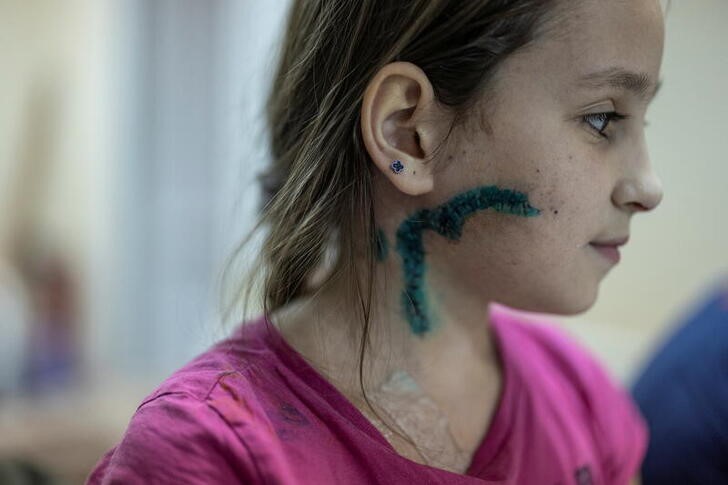 &copy; Reuters. Foto del martes de Milana, una niña de 11 años que se recupera de las heridas en un hospital en Zaporizhzhia
Mar 29, 2022. REUTERS/Marko Djurica