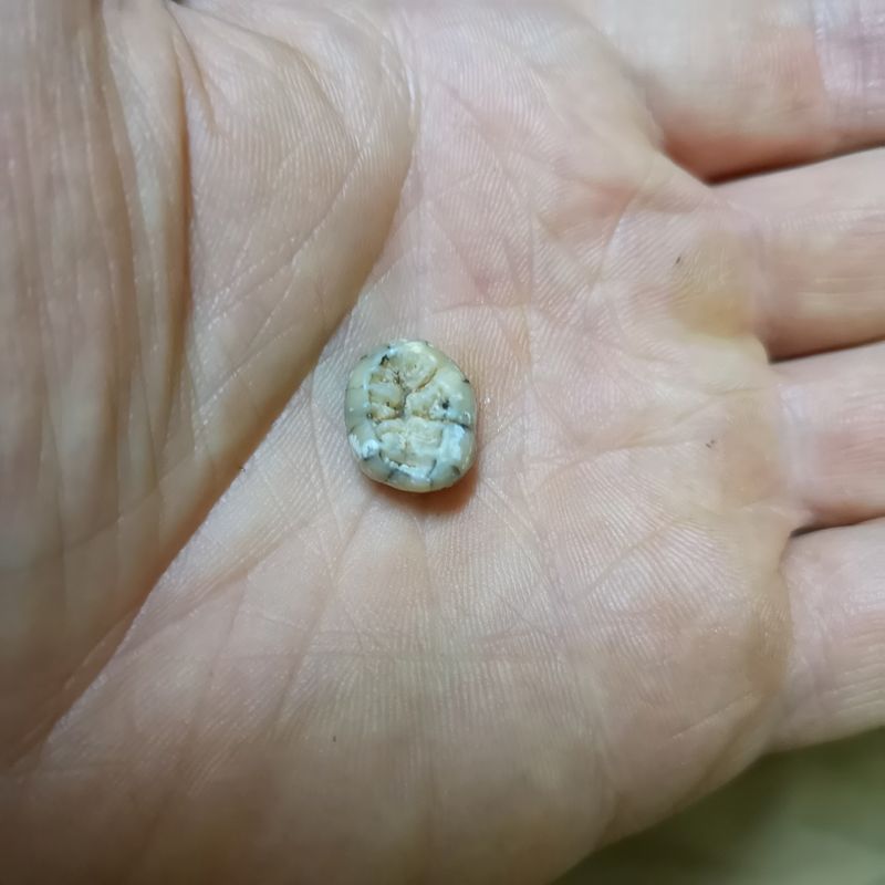 &copy; Reuters. El molar atribuido a un individuo femenino joven de la especie humana extinta llamada los Denisovanos, encontrado en la cueva Tam Ngu Hao 2 en el noreste de Laos, se ve en la mano del paleoantropólogo Fabrice Demeter en esta imagen en 2018. Fabrice Demet