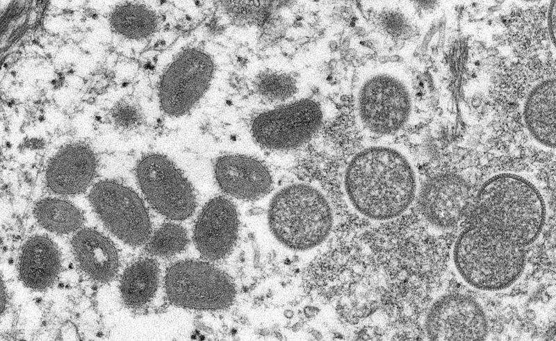&copy; Reuters. FOTO DE ARCHIVO: Una imagen de microscopio electrónico (EM) muestra partículas maduras del virus de la viruela del mono, de forma ovalada, así como semilunas y partículas esféricas de viriones inmaduros, obtenidas de una muestra clínica de piel huma