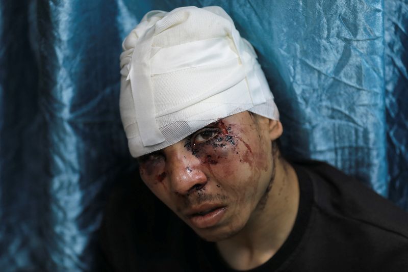 &copy; Reuters. رجل فلسطيني يدعى رمضان شملخ، يقول إن قوات أمن إسرائيلية اعتقلته وتعرض للضرب،  خلال وجوده في مستشفى شهداء الأقصى بدير البلح وسط قطاع غزة يوم 2