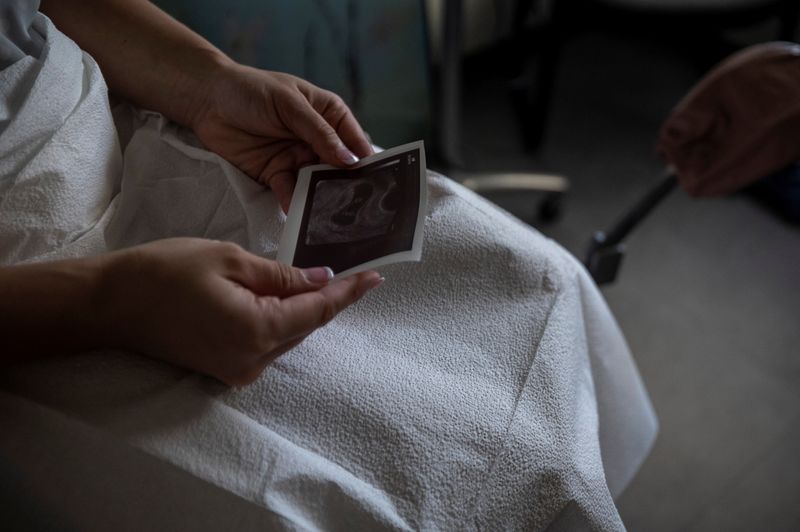 &copy; Reuters. FILE PHOTO: A patient looks at her ultrasound before proceeding with a medical abortion at Alamo Women's Clinic in Albuquerque, New Mexico, U.S., August 23, 2022. REUTERS/Evelyn Hockstein/File photo