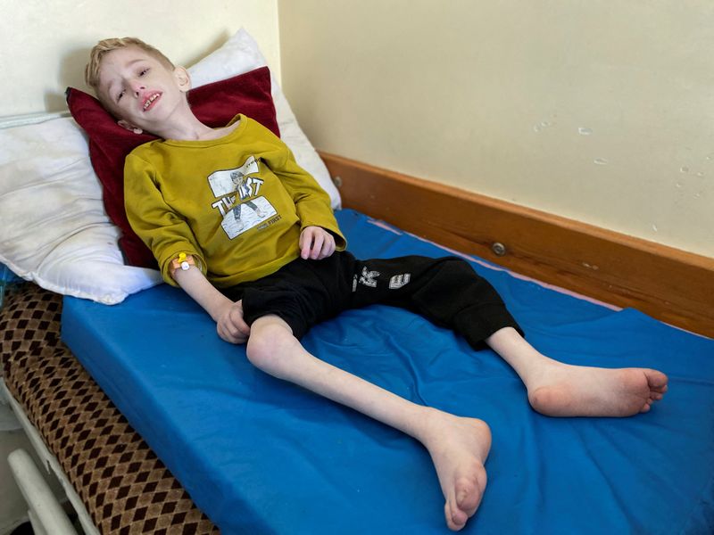 &copy; Reuters. El niño palestino desnutrido Fadi al-Zant yace en una cama del hospital Kamal Adwan, en medio del actual conflicto entre Israel y Hamás, en el norte de Gaza, 10 de marzo de 2024. REUTERS/Osama Abu Rabee