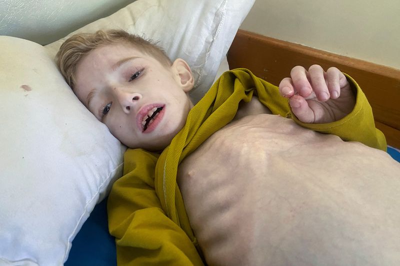 &copy; Reuters. الطفل الفلسطيني الزنط يرقد بمستشفى كمال عدوان في شمال غزة يوم العاشر من مارس 2024. تصوير: أسامة أبو ربيع - رويترز