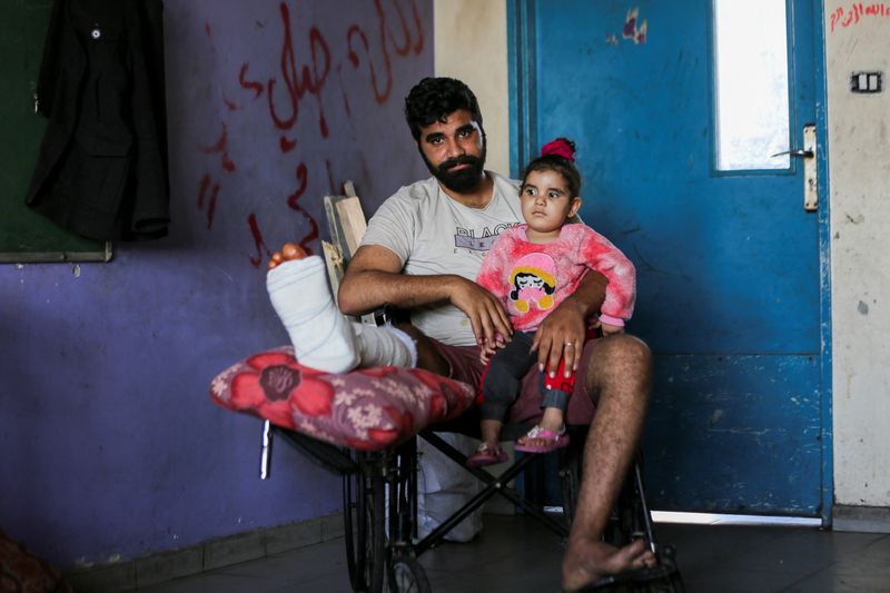 &copy; Reuters. Displaced Palestinian Hamza Abu Alkas, who was wounded while trying to receive aid, holds his daughter as he sits in a classroom at an UNRWA school where they shelter, amid the ongoing conflict between Israel and Hamas, in Gaza City, April 3, 2024. REUTER