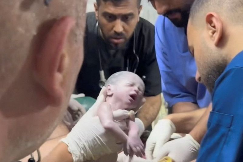 © Reuters. A medic holds a Palestinian newborn girl after she was pulled alive from the womb of her mother Sabreen Al-Sheikh (Al-Sakani), who was killed in an Israeli strike, along with her husband Shokri and her daughter Malak, at a hospital in Rafah in the southern Gaza Strip, in this still image taken from a video recorded April 20, 2024. Reuters TV via REUTERS